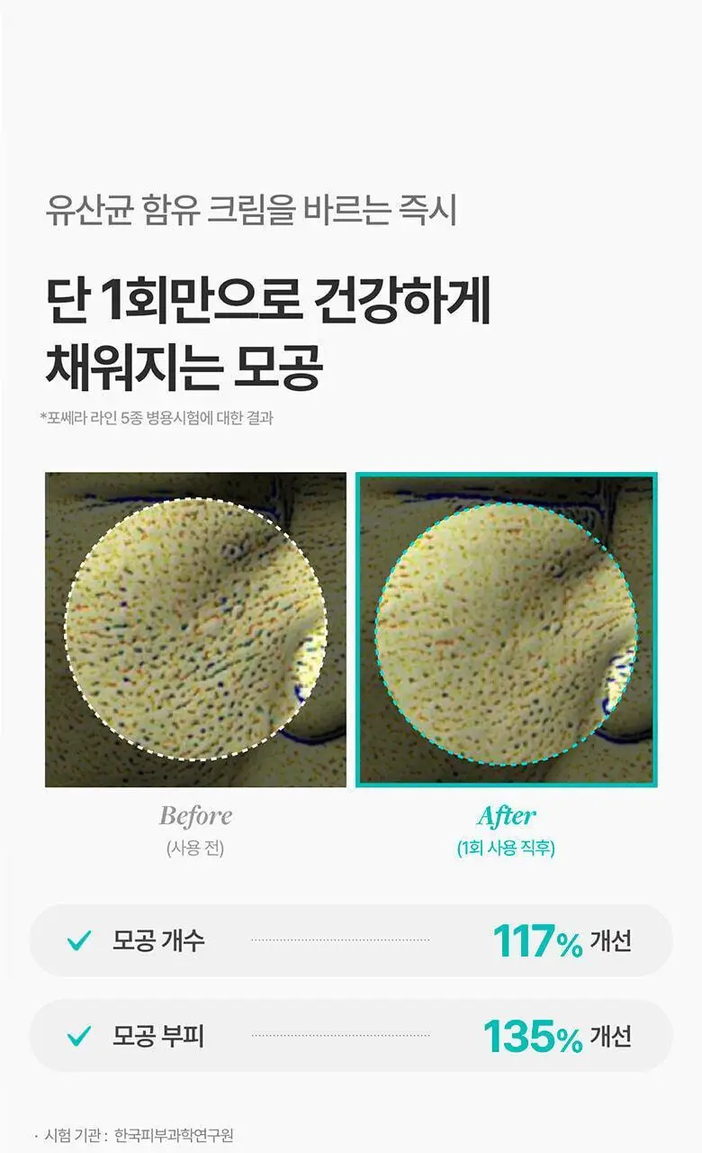 [모공개선/유산균톤업] 메디테라피 포쎄라 리얼 비피다 블러 크림 50ml 증량기획 (+20ml) 상세페이지 28